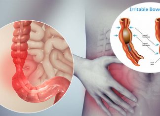 Hope for millions of Irritable Bowel Syndrome – researchers discovered receptors that cause gut itch