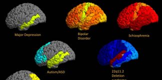 Research reveal that PTSD is highly polygenic