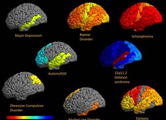 Research reveal that PTSD is highly polygenic