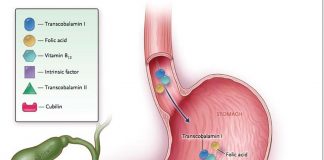 Pernicious anemia is an autoimmune disorder associated with vitamin B12 deficiency
