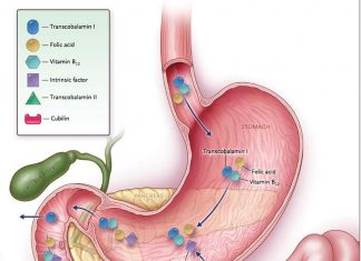 Pernicious anemia is an autoimmune disorder associated with vitamin B12 deficiency