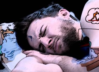 REM sleep behavior disorder (RBD) is common among veterans with PTSD