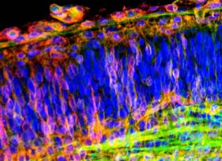 Researchers identify a new cell mechanism that connects Alzheimer’s disease and cancers