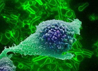 Scientists found that bacteria fingerprint predicts radiotherapy side effects