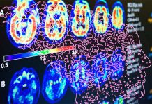 Driving Status and Predictors Among Older Adults with Cognitive Impairment: A Comprehensive Study