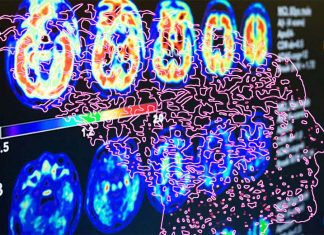 A new report projects the number of people living with dementia in the US will double to 13 million by 2040