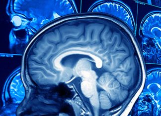 Researchers discovered a link between frontotemporal dementia and alterations in immune system function