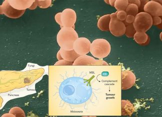 Certain fungi move from the gut to the pancreas and encourage pancreatic cancer growth