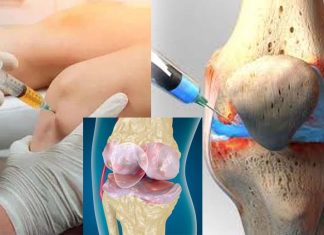 Corticosteroid injections used to treat osteoarthritis pain in the hip and knee may damage joints
