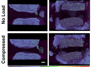Researchers may have found a way to press pause on spinal disc injuries