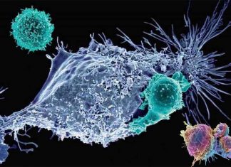 The first attempt in the United States to use a gene editing tool called CRISPR against cancer