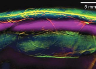 Dual Scan Mammoscope has the potential to help detect breast cancer earlier