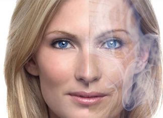 Heavy smoking has a causal effect on facial aging