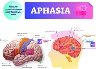 One of the main causes of aphasia is stroke