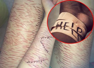 Youth who self-harmed were five times more likely to have repeat visits to the emergency department