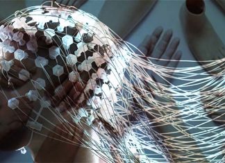 Following amputation brain reroutes the function to the remaining limb