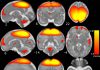The fundamental organization of brain networks is established in utero during the second and third trimesters of fetal development