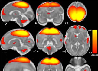 The fundamental organization of brain networks is established in utero during the second and third trimesters of fetal development