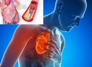 New method may give cardiologists additional data to identify patients at higher risk of future heart attacks