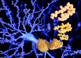 Aggregates of the protein alpha-synuclein arising in the gut may play a key role in the development of Parkinson’s disease (PD)