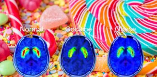 How does sugar affect the brain and the body?