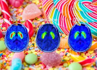 How does sugar affect the brain and the body?