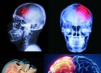 Researchers developed a breakthrough cell therapy to improve memory and prevent seizures