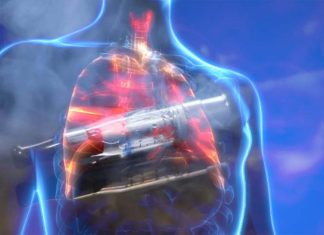 E-cigarette use significantly increases a person’s risk of developing chronic lung diseases