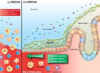 Researchs developed engineered probiotic to treat Inflammatory Bowel Disease (IBD)