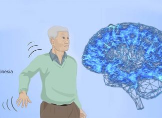 New cannabis substitute can reduce L-dopa induced dyskinesia in Parkinson’s patients