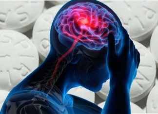 Higher doses of aspirin can help reduce acute symptoms during the onset of a migraine attack