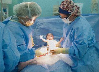 The researchers found no evidence to support a link between caesarean sections and the development of obesity