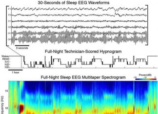 Researhcers created a open source multitapered spectrogram for electroencephalogram (EEG) analyses