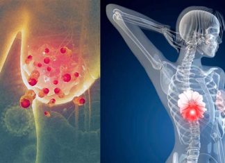 Researchers have identified a genetic signature with prognostic value for certain kinds of breast cancer
