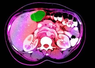Researchers identified a sudden transcriptomic switch that turns healthy liver tissue cancerous