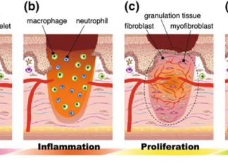 Researchers decoded the process that transforms an open wound into remodeled healthy tissue