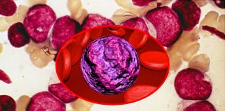 Acute Myeloid Leukemia (AML) grows by taking advantage of the B6 vitamin to accelerate cell division
