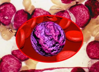 Acute Myeloid Leukemia (AML) grows by taking advantage of the B6 vitamin to accelerate cell division