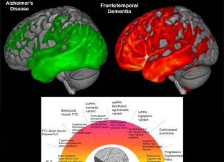 Gentamicin and G418 were effective at correcting genetic mutations associated with a specific form of frontotemporal dementia
