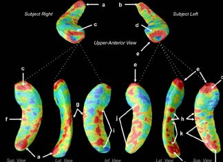 Greater hippocampal volume is not always a reliable predictor of learning and memory ability in older adults