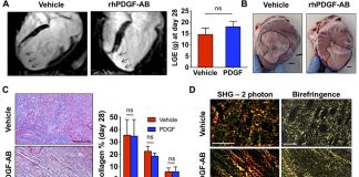 A protein therapy – recombinant human platelet-derived growth factor-AB (rhPDGF-AB) could improve outcomes following heart attack