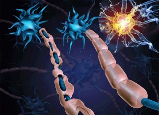 Protease Activated Receptor 1 (PAR1) could be the new strategie for treating multiple sclerosis (MS)