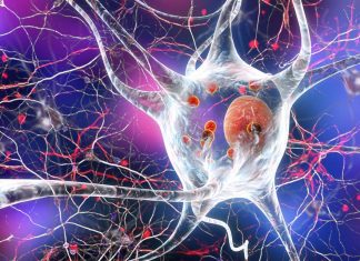 People who suffer from ASD have a cellular abnormality that impairs production of myelin