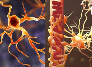 Astrocytes hijack microglia for the benefit of tumor growth in medulloblastoma