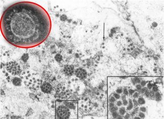Coronavirus – Diarrhea may be a secondary path of transmission