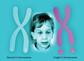 Fragile X syndrome : repeating elements within DNA cause neurodegenerative diseases