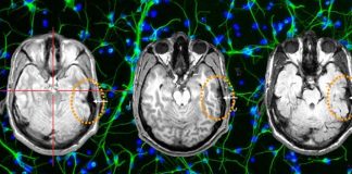 MRI has limited applicability in assessing sanity
