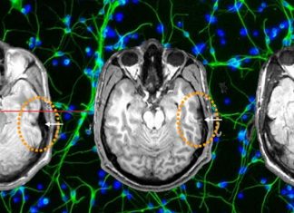 MRI has limited applicability in assessing sanity
