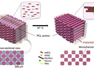 Neural cells integrated into 3D bioprinted skeletal muscles can accelerate functional muscle regeneration