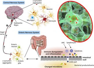 Parkinson’s disease (PD) : people experience disturbances in gastrointestinal function years before motor symptoms set in